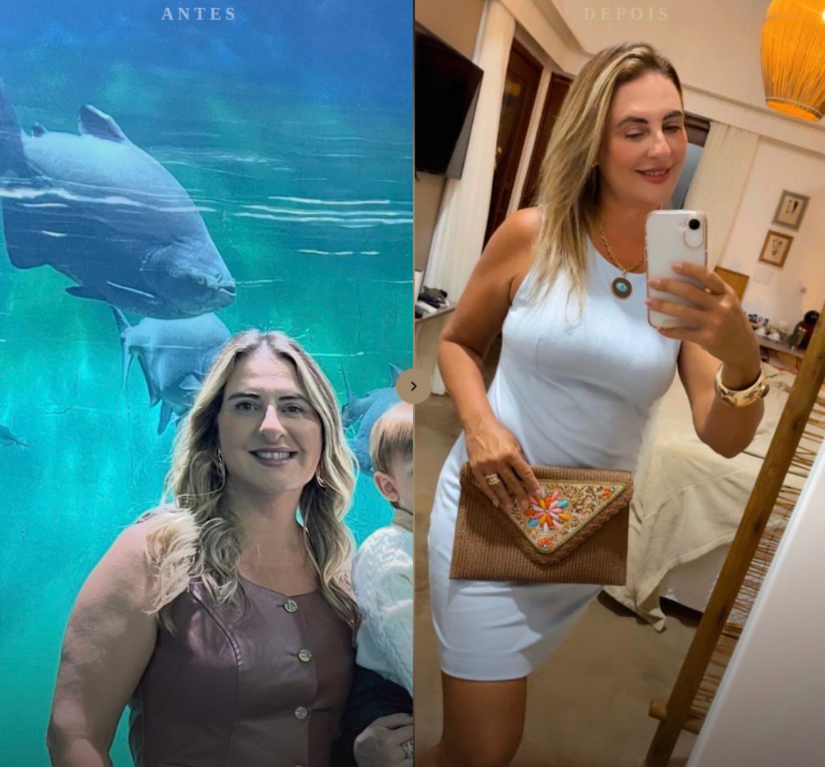 Antes e depois de uma leitora do Método Barriga Leve